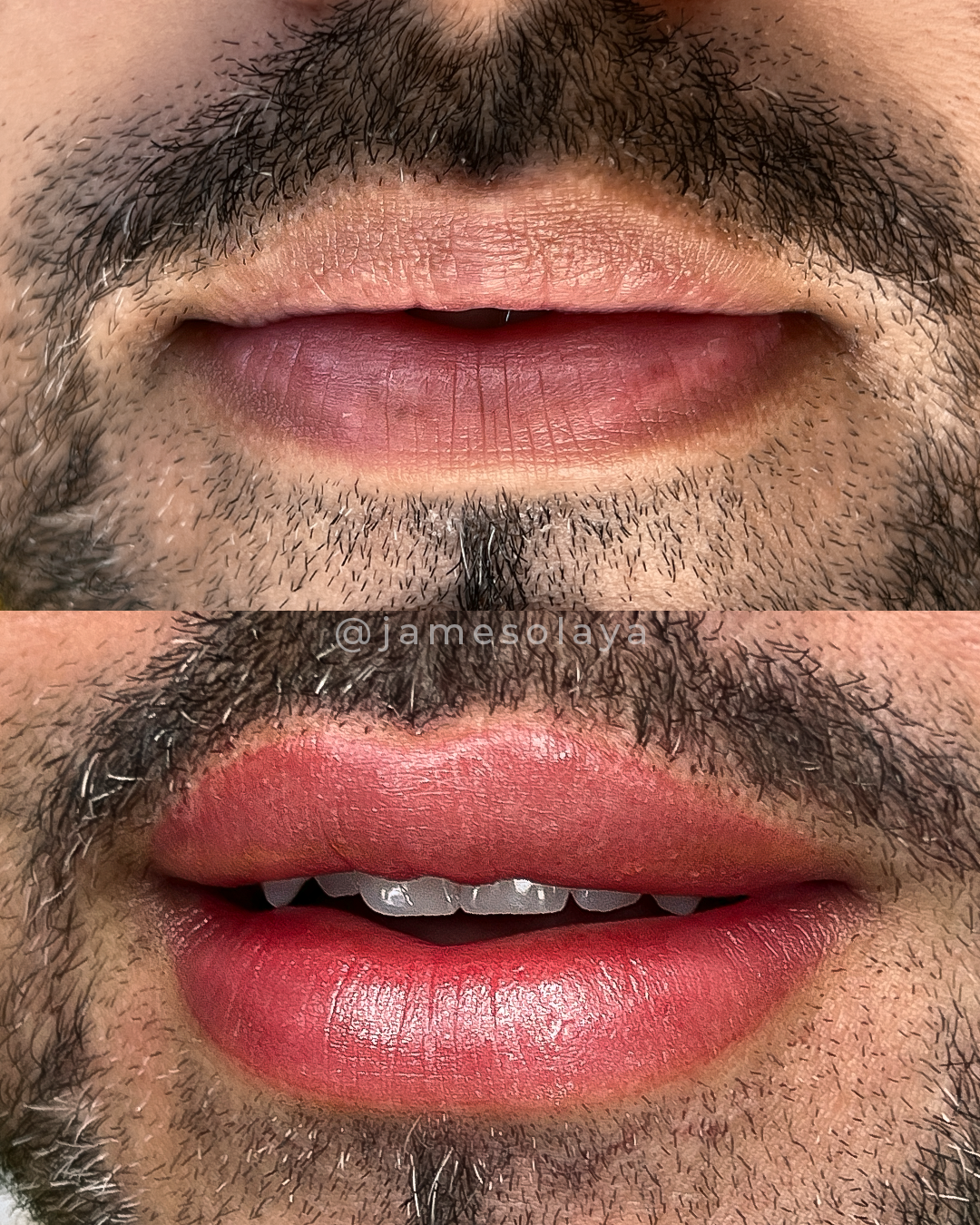 Micropigmentação labial masculina